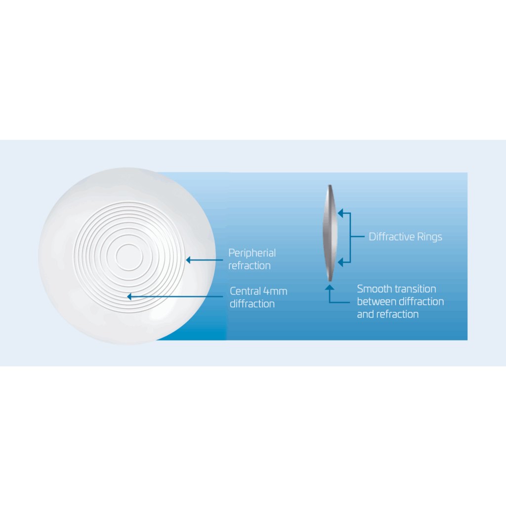 maxvision grafik 1 englisch