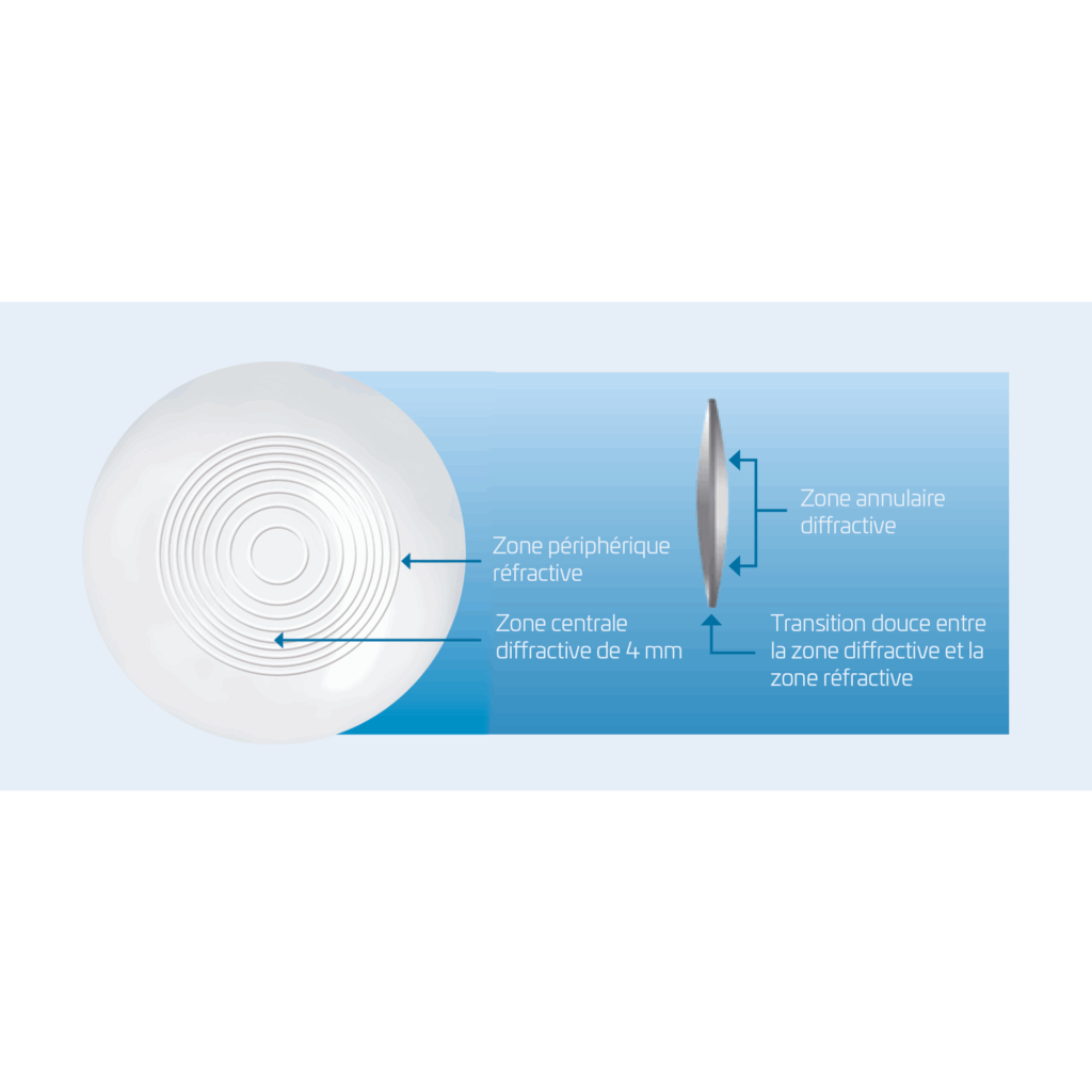 maxvision grafik 1 französisch